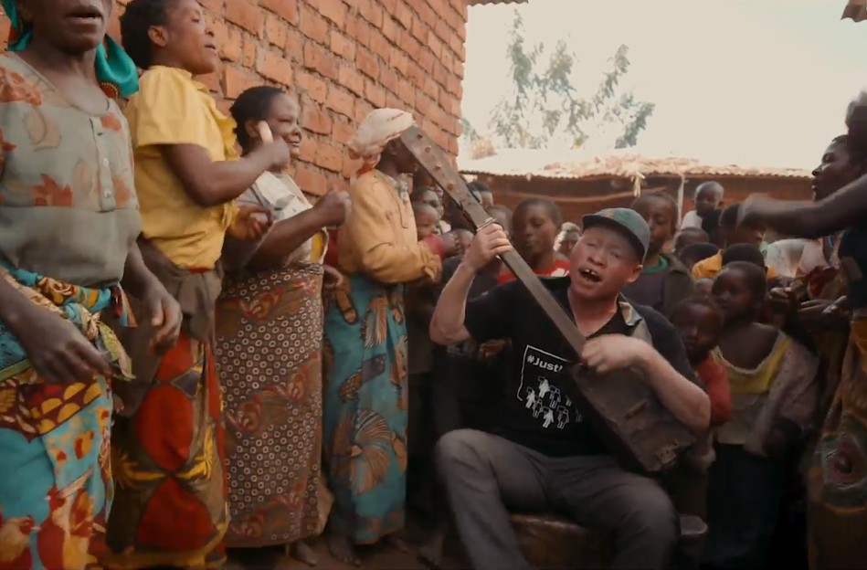The inspiring story of an albino musician from Malawi