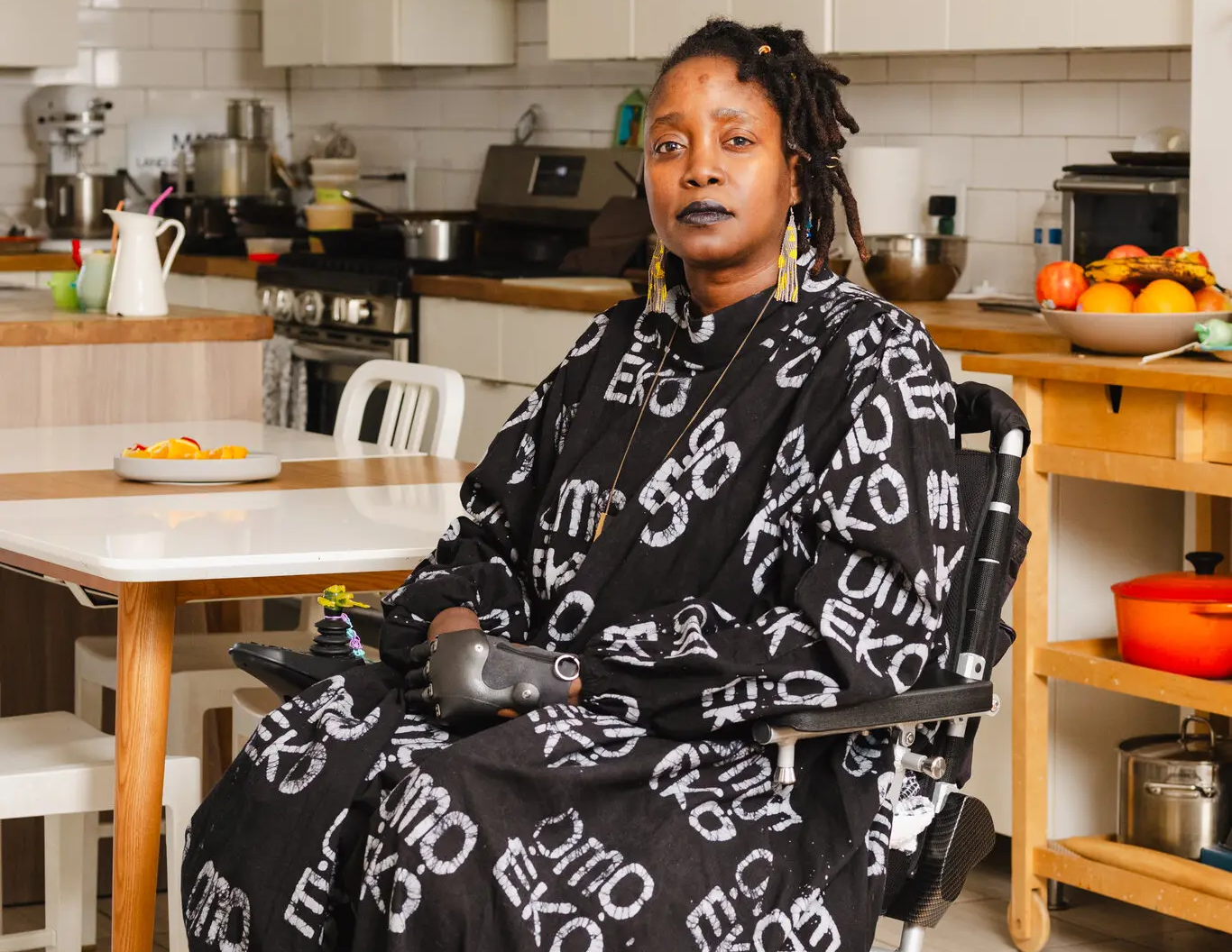 NYT cooking columnist woke up with no legs and missing fingers